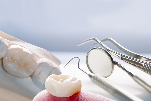 Who Should Consider Getting Dental Crowns?