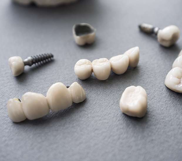 Turlock The Difference Between Dental Implants and Mini Dental Implants