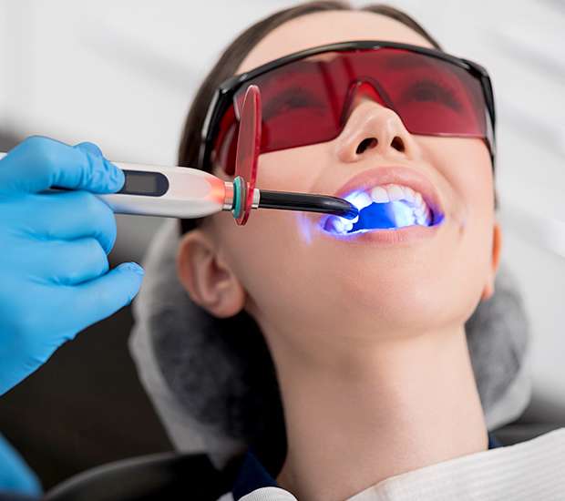 Turlock Professional Teeth Whitening