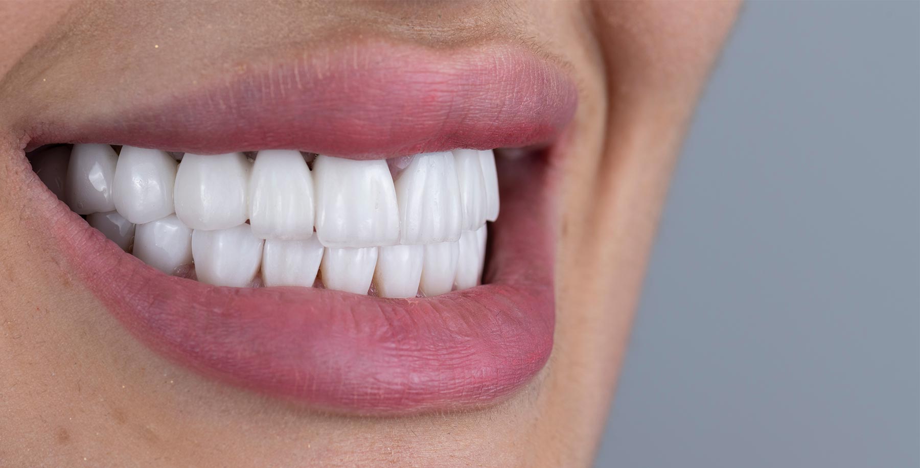 Dentist in Turlock, CA Local Dentist Turlock Dentistry And Implants